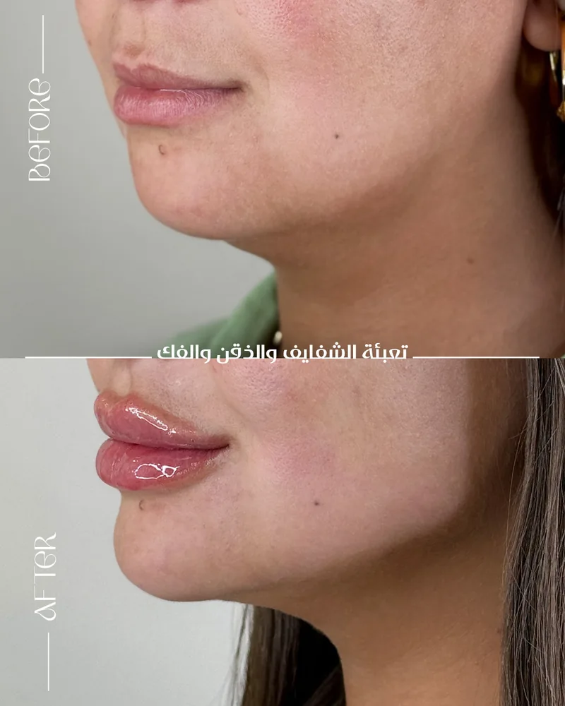 Before and after image for case 15