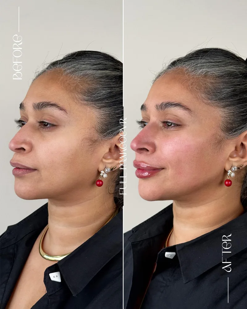 Before and after image for case 02