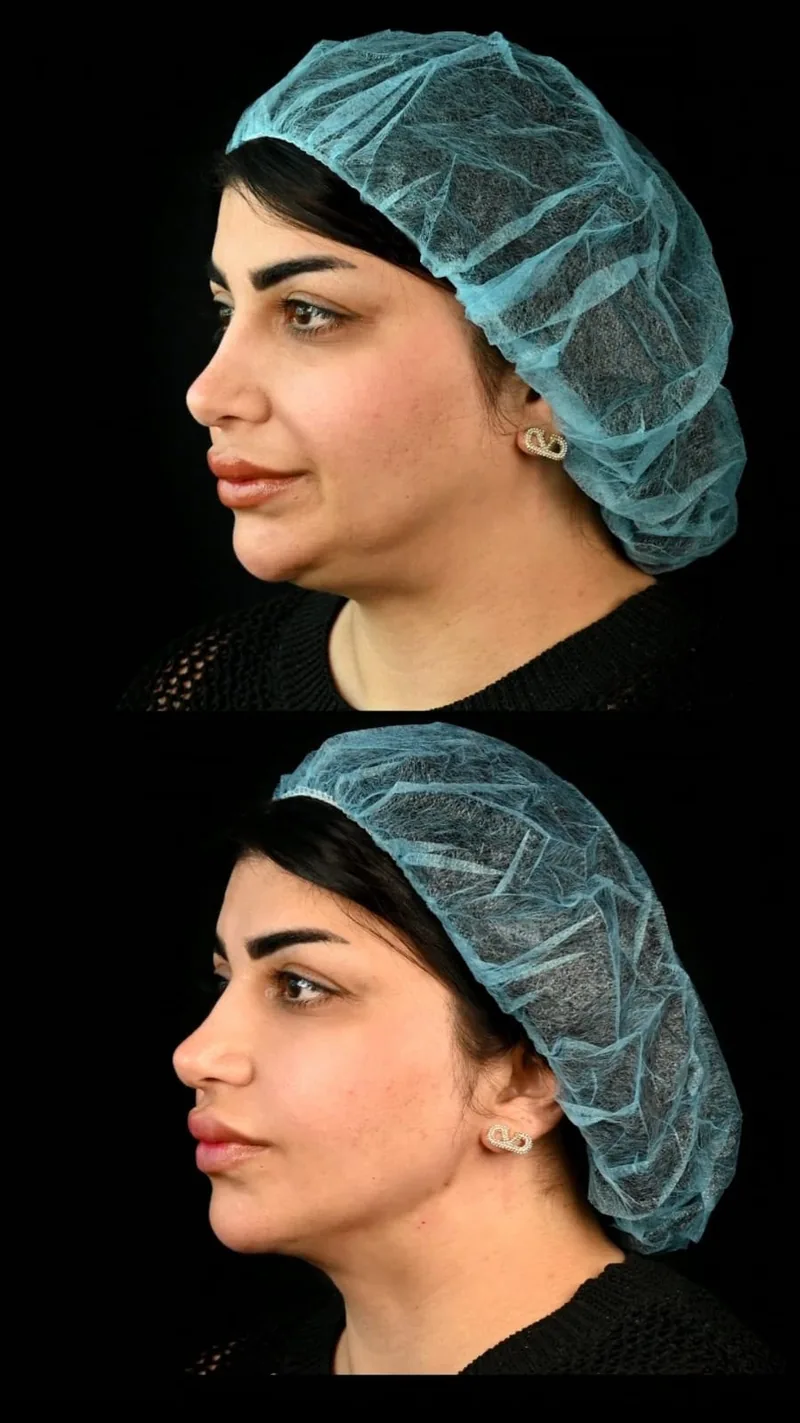 Before and after image for case 03