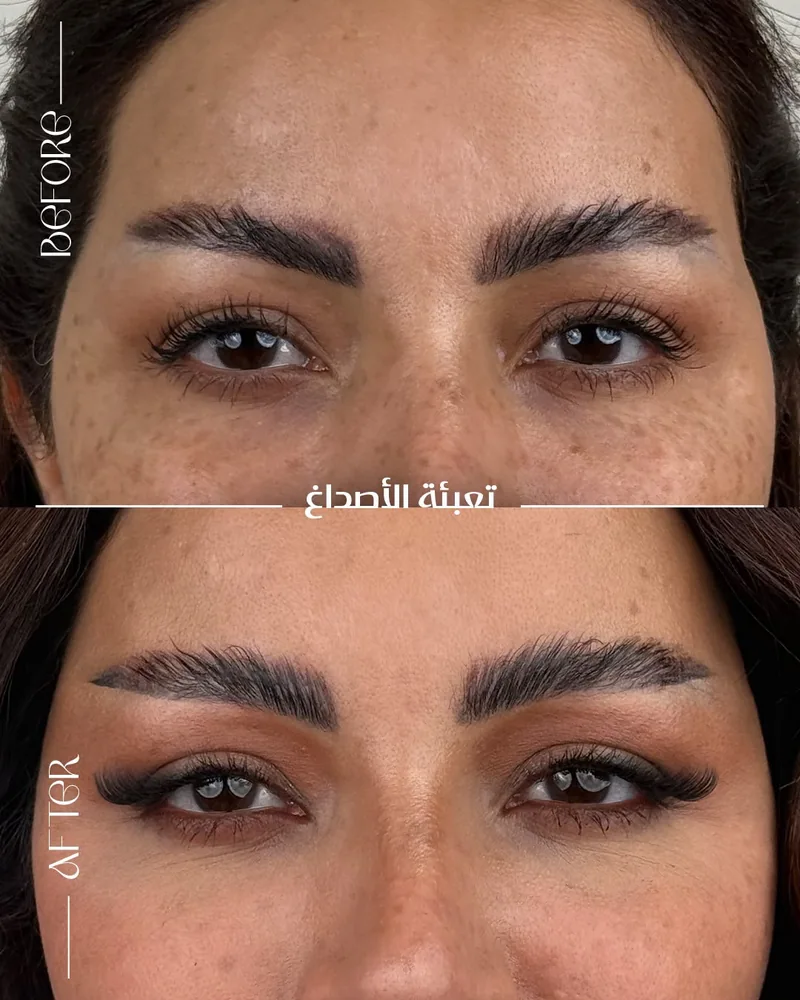 Before and after image for case 04