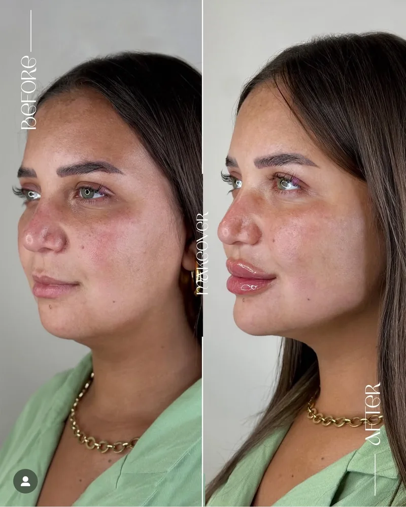 Before and after image for case 05