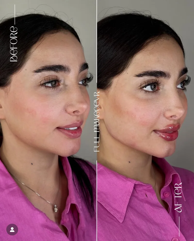 Before and after image for case 06