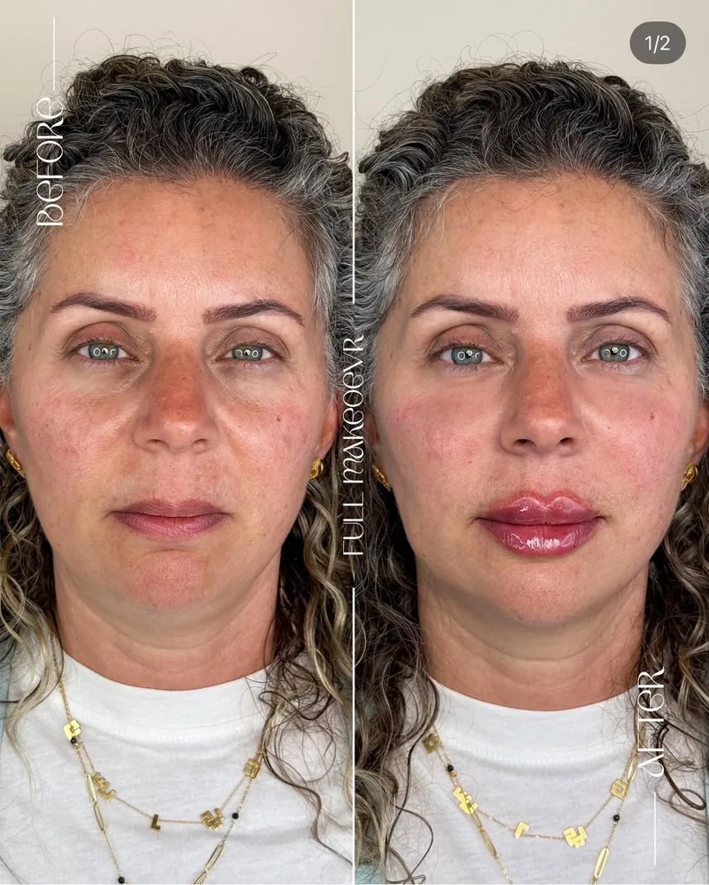 Before and after image for case 07