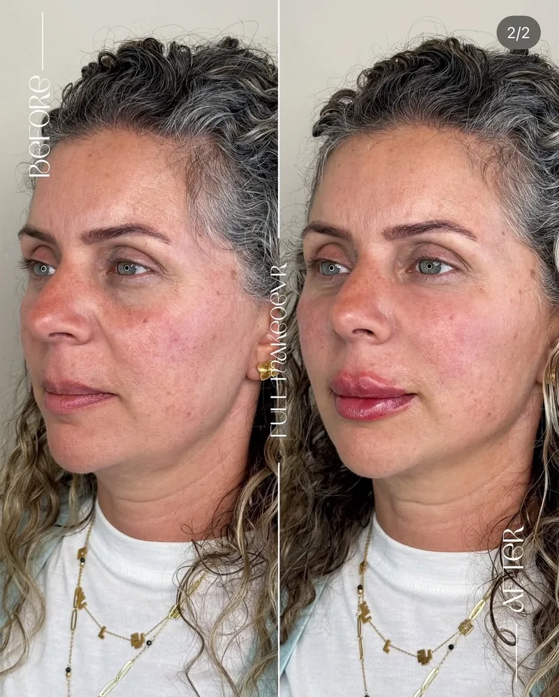 Before and after image for case 08