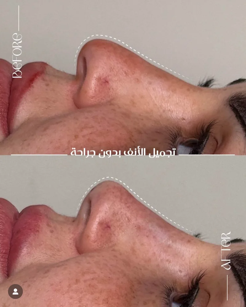 Before and after image for case 09