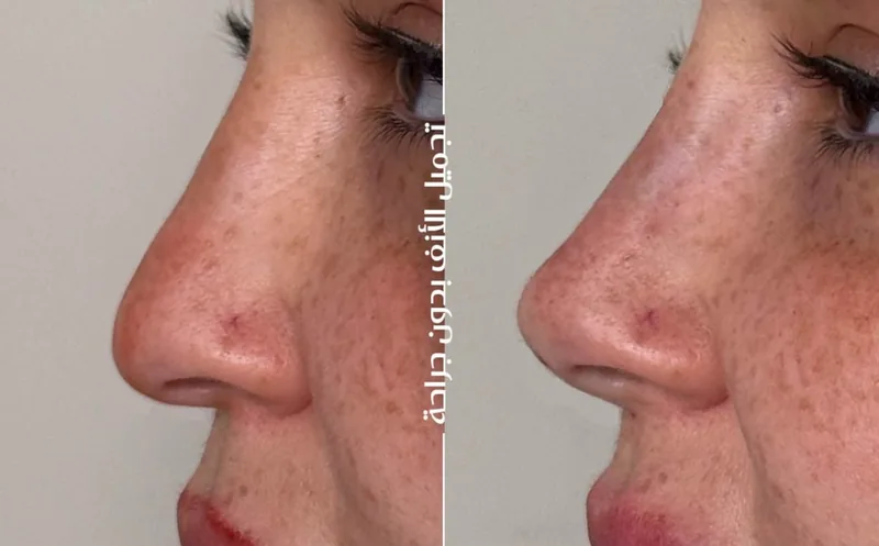 Before and after image for case 10
