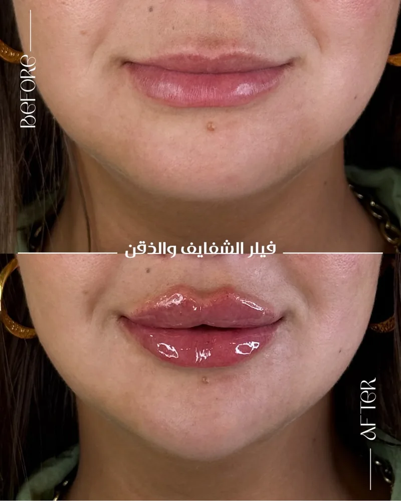 Before and after image for case 11