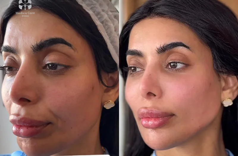 Before and after image for case 12