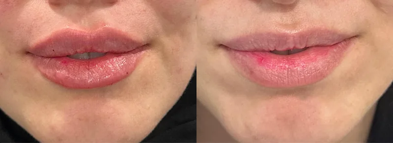 Before and after image for case 13
